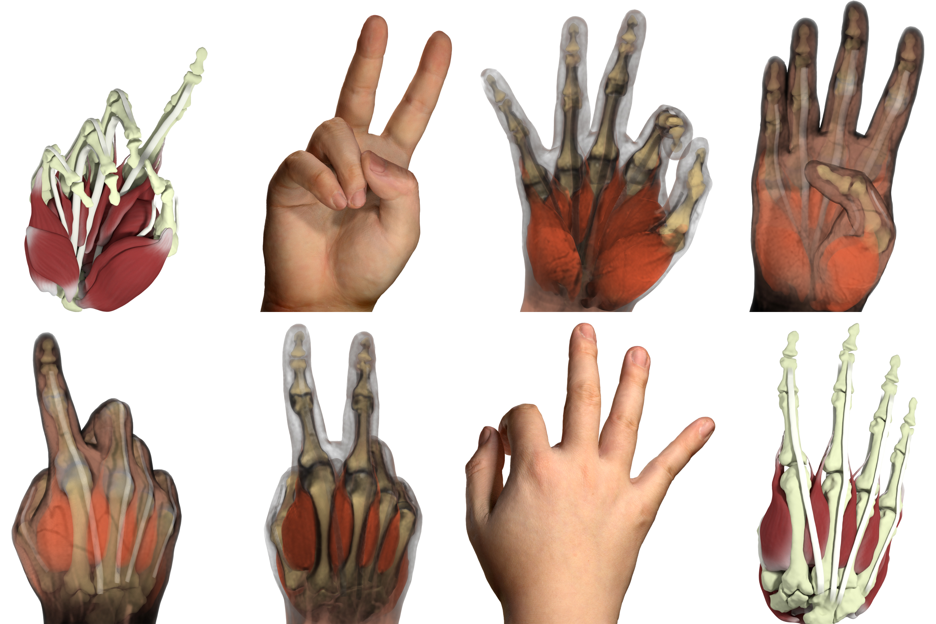 Hand with simulated anatomy